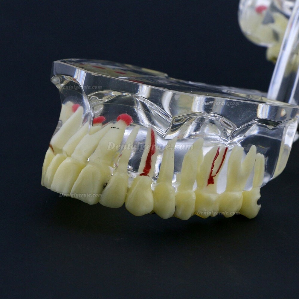 Neue Dental Teach-Studie Allgemeine Erwachsenenpathologie Typodont Z&auml;hne Modell # 4001